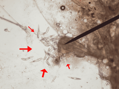 Demodex mites under microscope