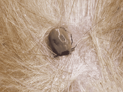 Ixodes tick implanted into hair